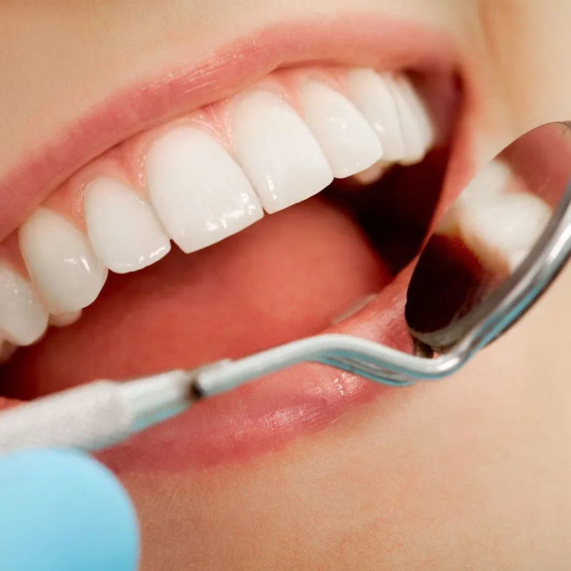 Sonrisa sana revisada con espejo dental, tratamiento de endodoncia en Florida Centro Dental